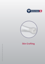 Nouvag-SkinGraftingCover